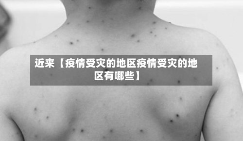 近来【疫情受灾的地区疫情受灾的地区有哪些】