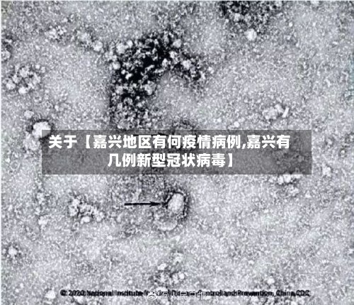 关于【嘉兴地区有何疫情病例,嘉兴有几例新型冠状病毒】-第2张图片