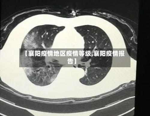 【襄阳疫情地区疫情等级,襄阳疫情报告】-第2张图片