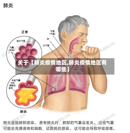 关于【肺炎疫情地区,肺炎疫情地区有哪些】