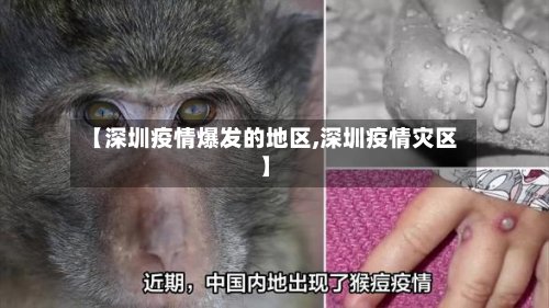 【深圳疫情爆发的地区,深圳疫情灾区】-第2张图片