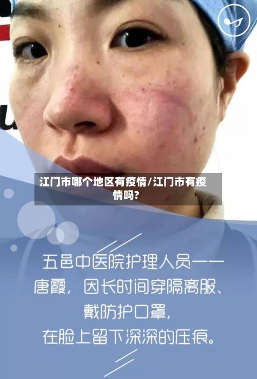 江门市哪个地区有疫情/江门市有疫情吗?