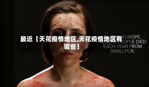 最近【天花疫情地区,天花疫情地区有哪些】