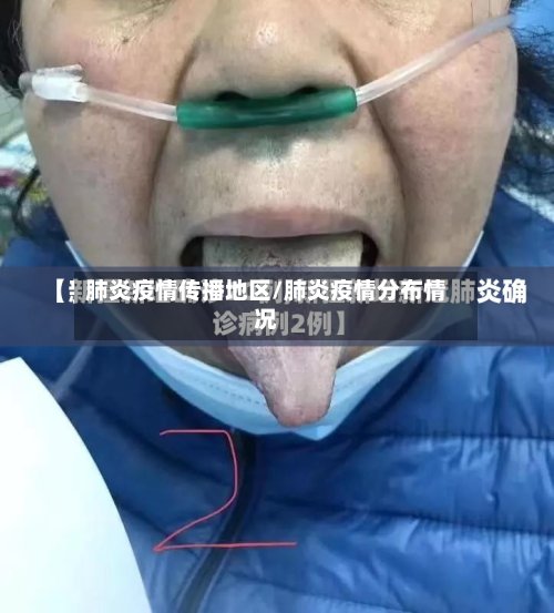 肺炎疫情传播地区/肺炎疫情分布情况