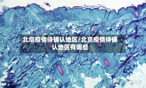北京疫情待确认地区/北京疫情待确认地区有哪些-第3张图片