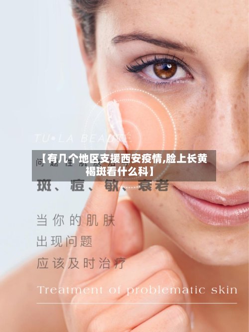【有几个地区支援西安疫情,脸上长黄褐斑看什么科】